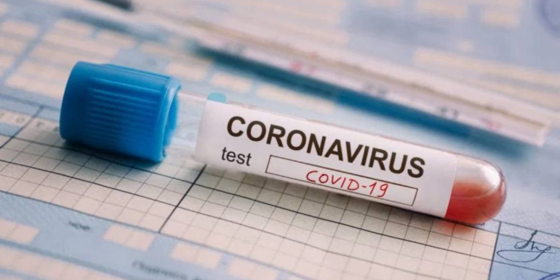 SALUD REALIZARÁ EN RONDA UN CRIBADO GENERAL A LA POBLACIÓN PARA CONOCER LA INCIDENCIA DE LA COVID